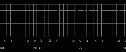 Dostępność kredytów rośnie, ale spada